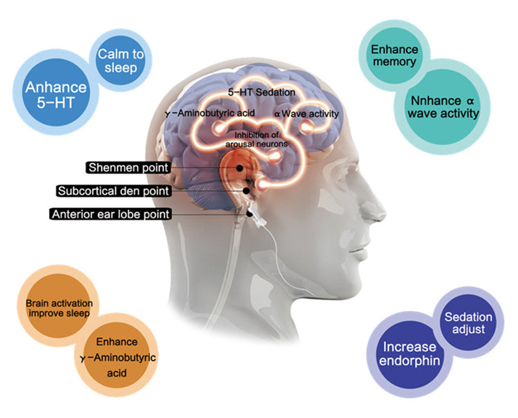 Insomnia device improves sleep artifact and helps sleep