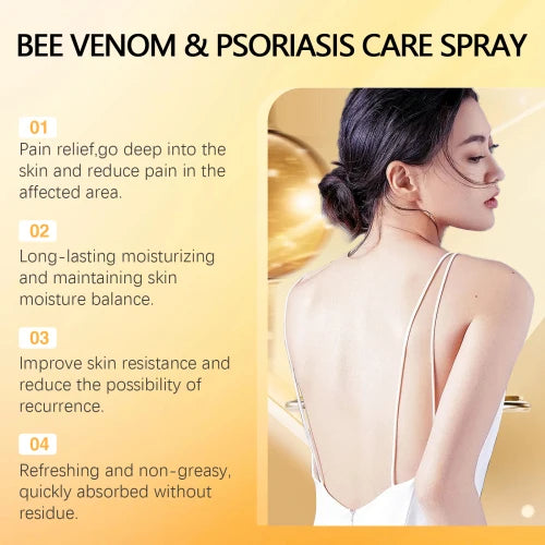 Ximonth Bee Venom  Psoriasis Spray Herbal Cooling Anti-Itch Skin Care Anti-Dandruff Light Redness