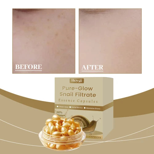 Hoygi Snail Firming Skin Care Essence Nourishes The Face And Rejuvenates The Skin's Natural Elasticity Snail Essence