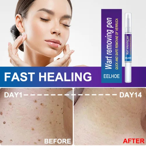EELHOE Pen Gently Cleanses Skin Care Body Face Label Meat Pellet Kayu Liquid
