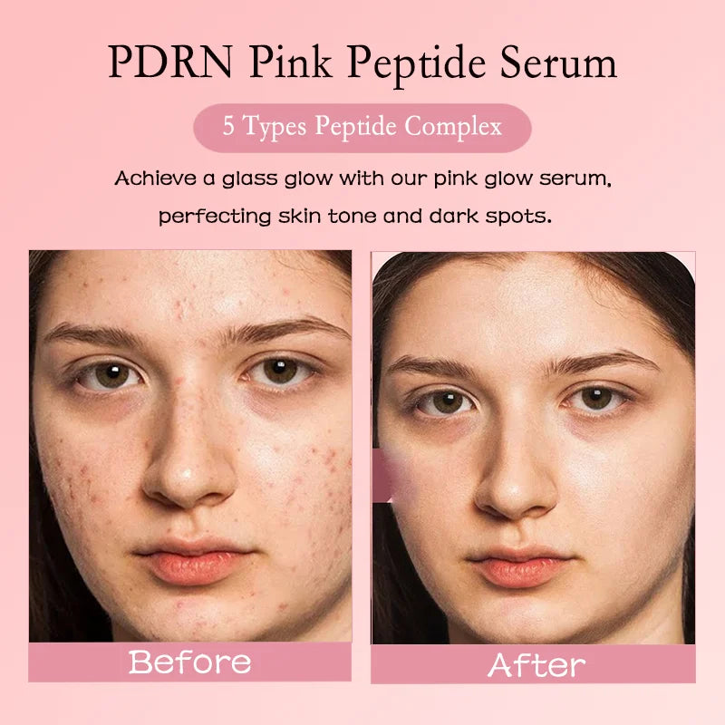 G Private Label PDRN Skin Care Anti Aging Polynucleotides Serum PDRN  Ampoule EGF PDRN  Salmon DNA Serum Skin Booster 30ml