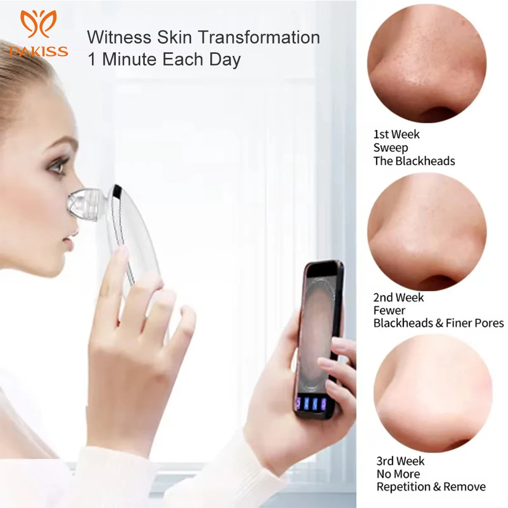 Electric Blackhead Remover With WiFi  App Wireless Camera Observation Skin Care Tools  Blackhead Remover Vacuum With Camera