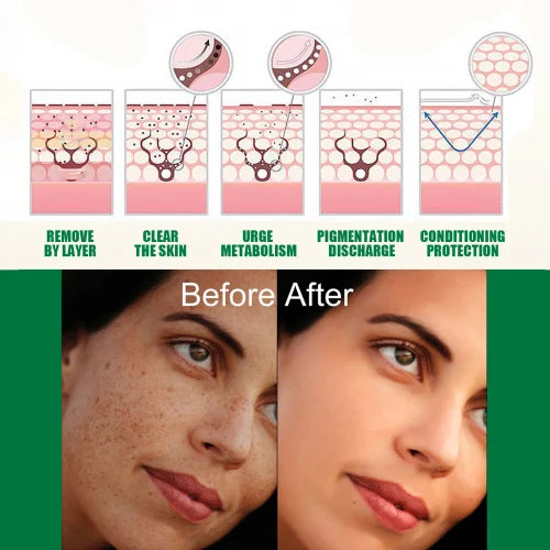 EELHOE Brightening Essence lightens spots moisturizes facial  hydrates brightens daily skin care and beauty