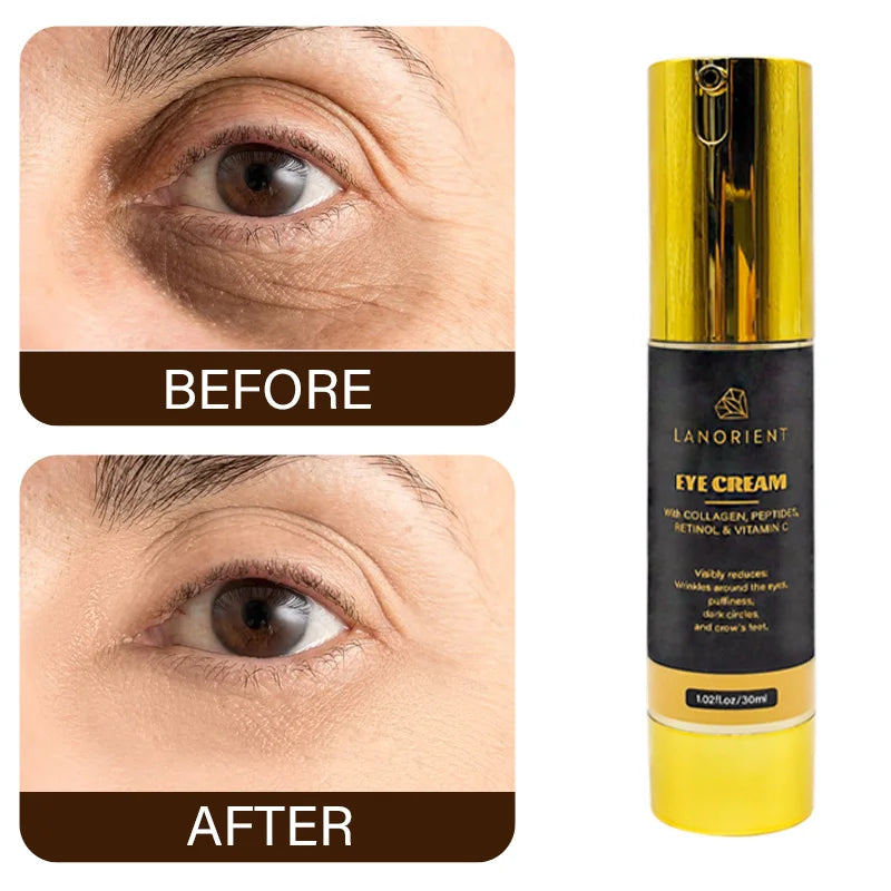 OEM Customized Korean Skin Care Cosmetics to Remove Dark Circles Brightening Niacinamide Eye Cream Retinol Eye Tightening Cream