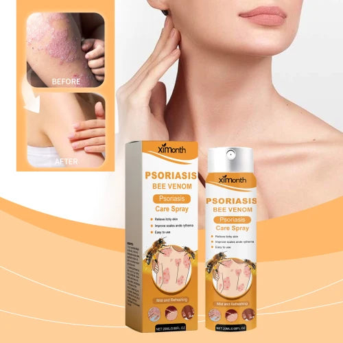 Ximonth Bee Venom  Psoriasis Spray Herbal Cooling Anti-Itch Skin Care Anti-Dandruff Light Redness