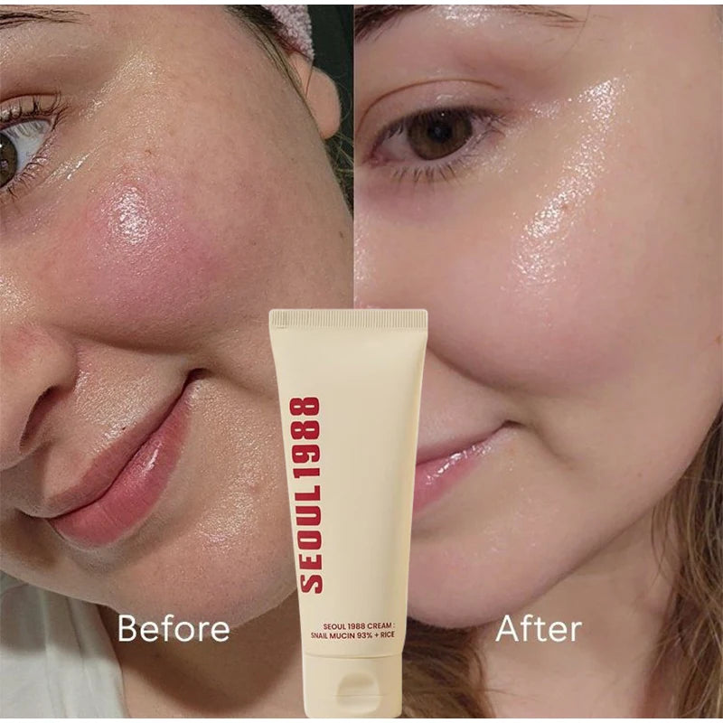Seoul 1988 Snail Mucin Cream 100ml Rice Soothing Moisturizer Skin Antiaging Repair Cream 92% Snail Filtrate Hydrating Face Cream