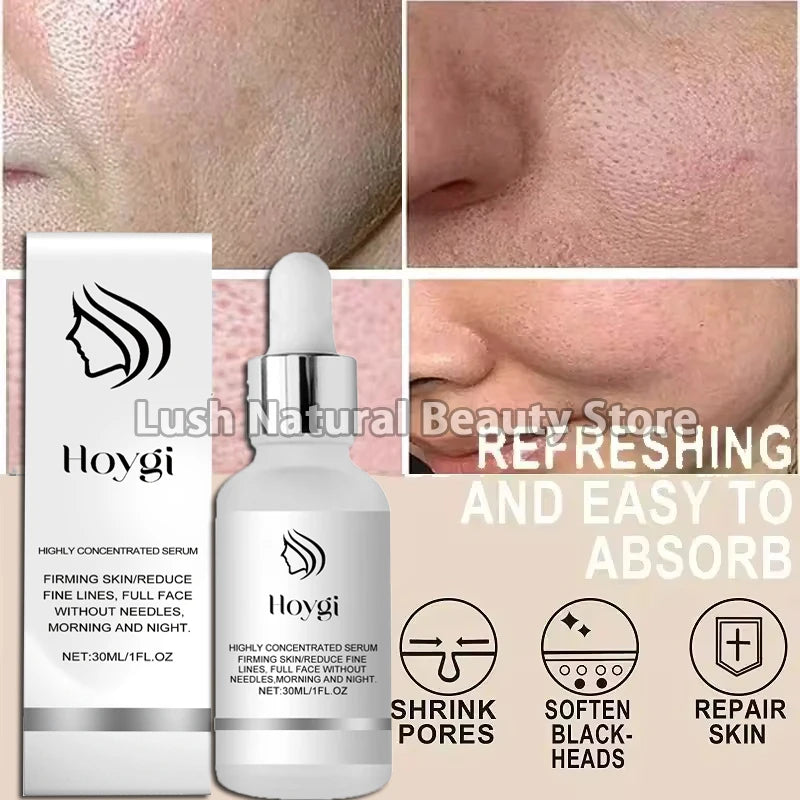 Remove Large Pores Serum Lactic Acid Facial Pore Shrinking Repairing Product Pore Minimizing Firming Smooth Korean Skin Care New