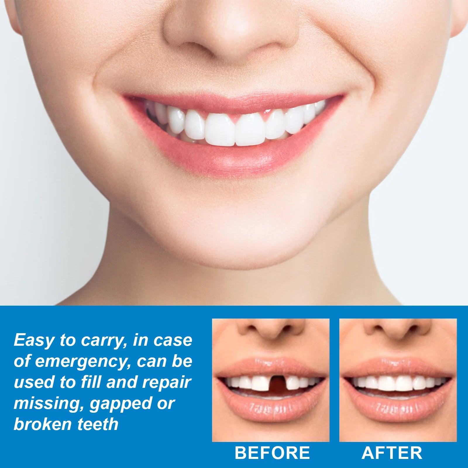 30g Temporary Tooth Repair Moldable Teeth And Gaps False Tooth Solid Gel Adhesive Fake Teeth Beauty Tool Dental Supplies