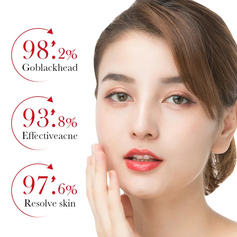 Salicylic Acid Acne Removing Essence Face Serum skincare Moisturizing Repairing Acne Treatment Facial Serum Skin Care