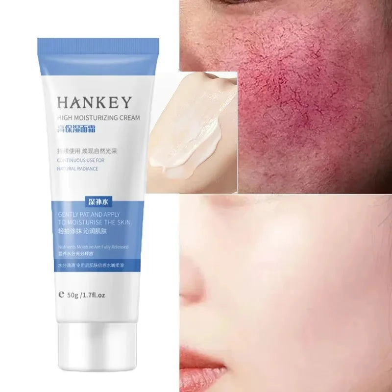 Facial Redness Repair Cream Improve Sensitive Skin Dryness Moisturizer Hydrating Sooth Lotion Removal Rosacea Korean Cosmetics
