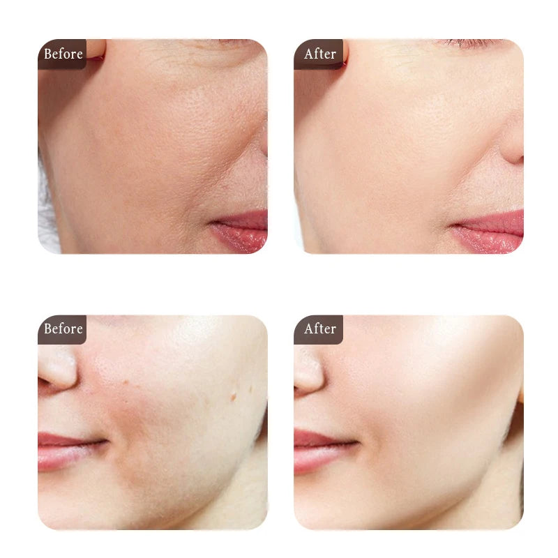 Moisturizing Face Serum and Cream Brighten Firming Anti-wrinkle Collagen Pre-Essence Caviar Eye Cream Dark Circle Eyebag Remover