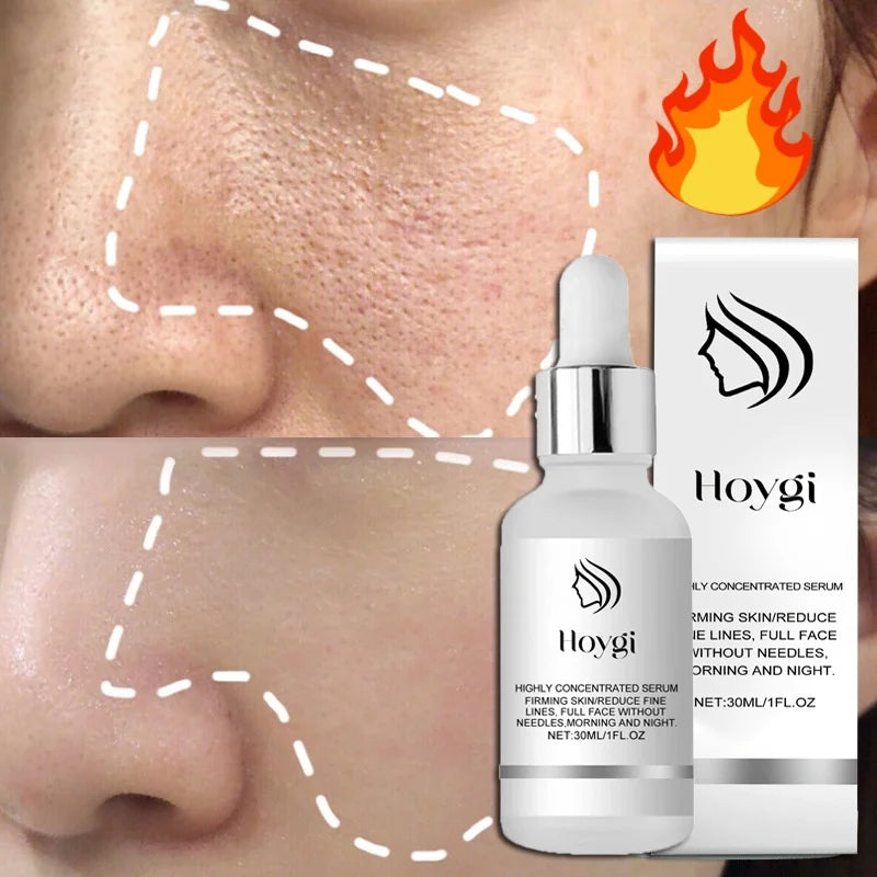 Remove Large Pores Serum Lactic Acid Facial Pore Shrinking Repairing Product Pore Minimizing Firming Smooth Korean Skin Care New