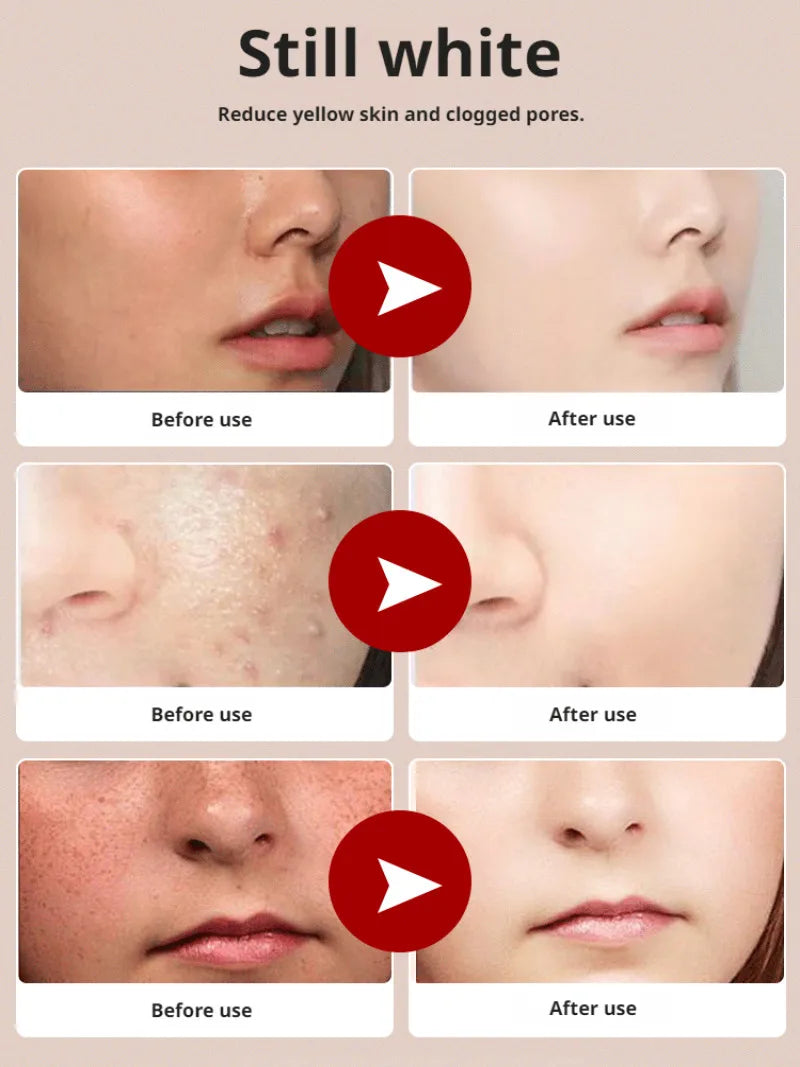 Niacinamide Whitening Facial Cleanser Shrink Pores Deep Cleaning Brightening Cleanser Oil Control Hydrating Face Wash Cleanser