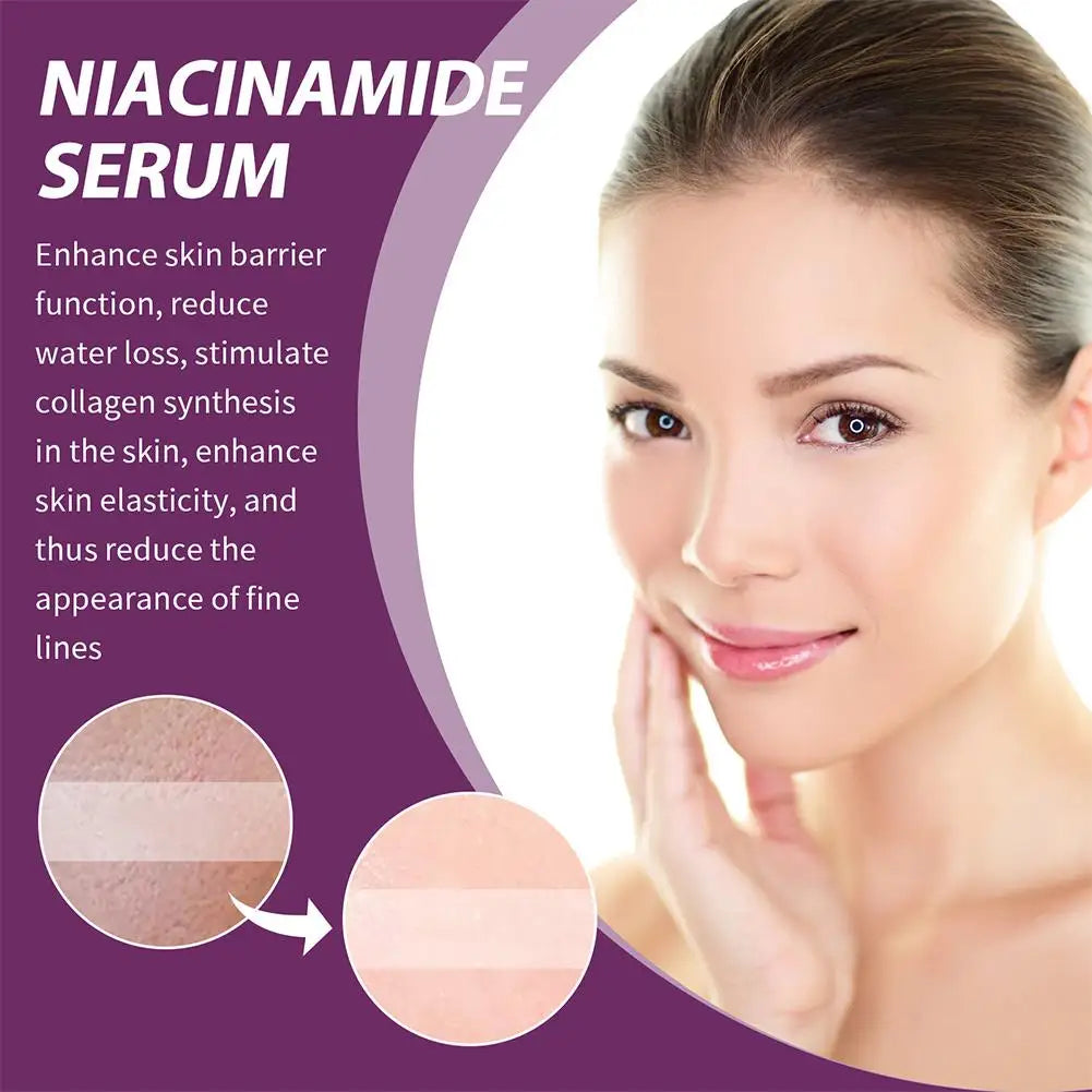 20% Niacinamide B3 Concentrated Serum for -Aging, Minimizing Large Pores & Discoloration, -Free, 0.67 Ounce Skin Care Blemish