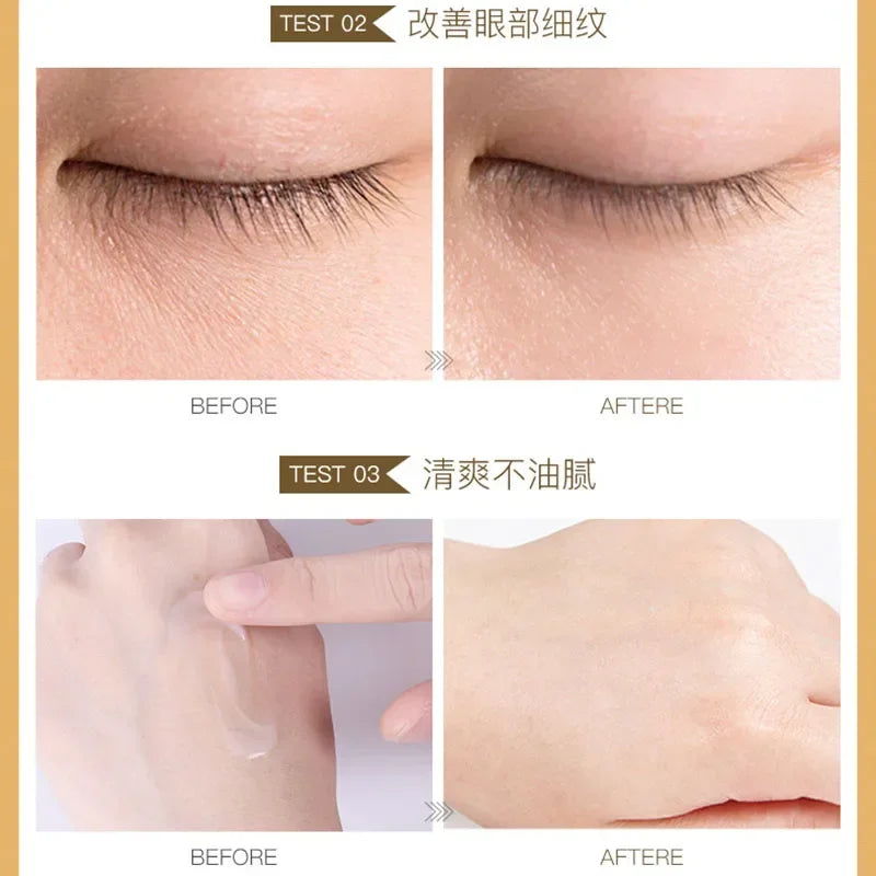 IMAGES Snail Eye Cream Whitening Moisturizing Anti-aging Wrinkle Remove Dark Circles Snail Cream Skin Care