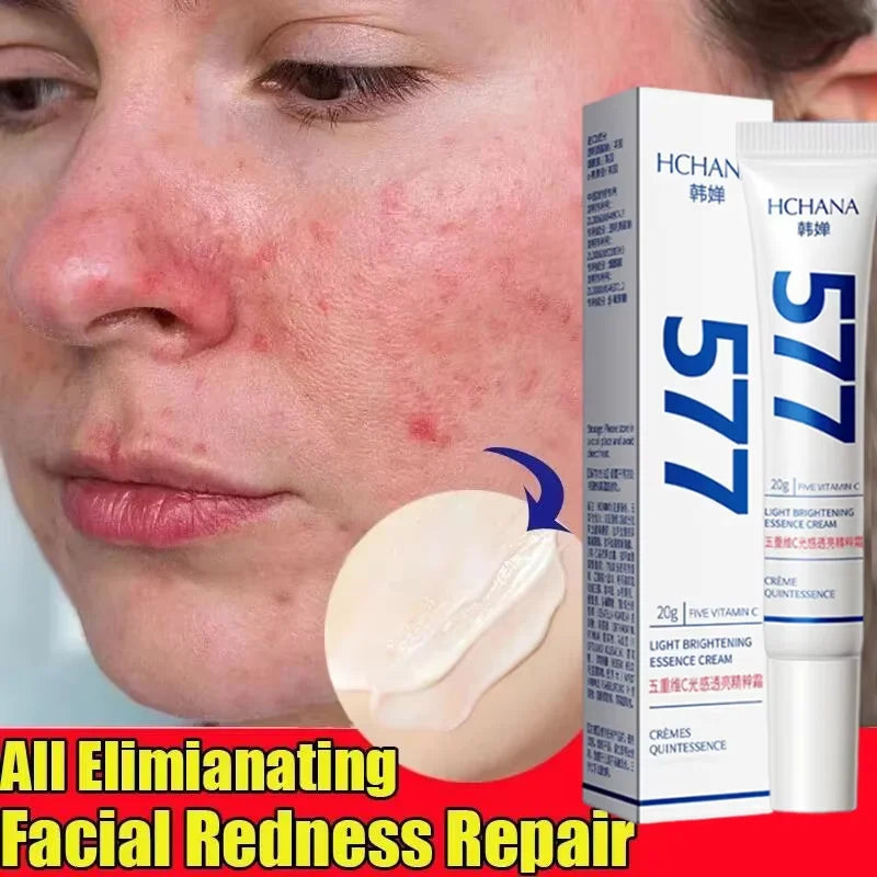 Facial Redness Repair Cream Improve Sensitive Skin Dryness Moisturizer Hydrating Sooth Lotion Removal Rosacea Korean Cosmetics