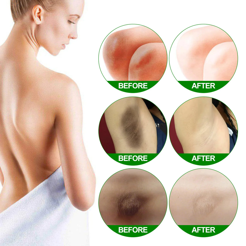 EELHOE Bleaching Body Lightening Cream Underarm Whitening Private Armpit Body Cream Legs Whitening Parts Cream Knees Skin Care