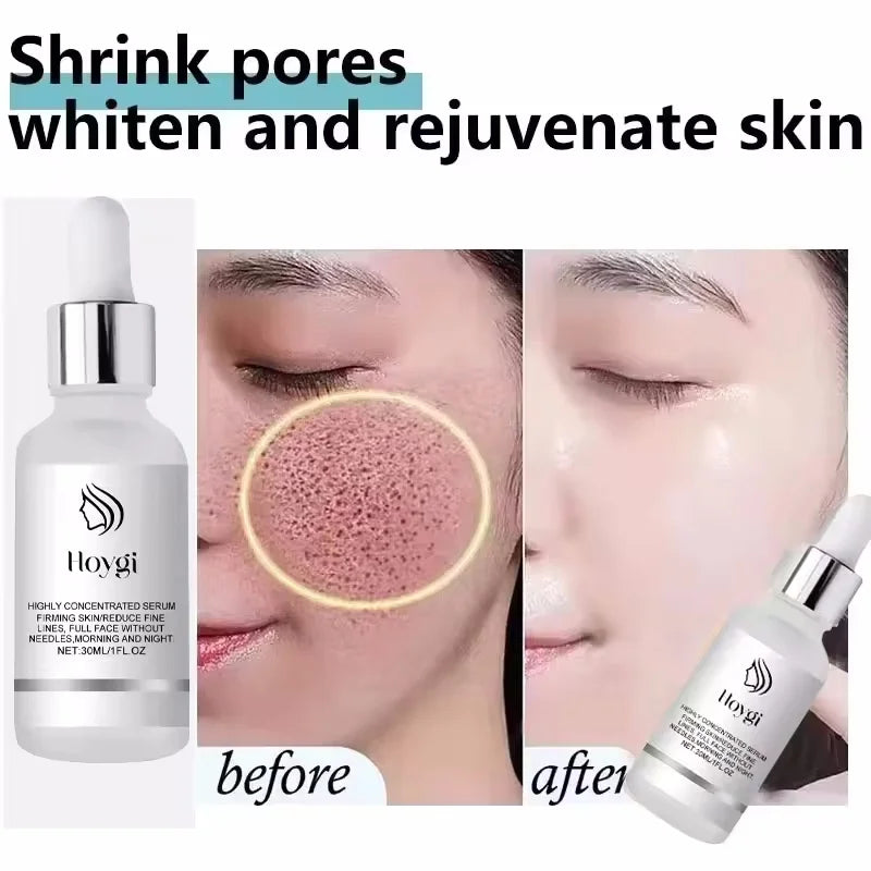 Remove Large Pores Serum Lactic Acid Facial Pore Shrinking Repairing Product Pore Minimizing Firming Smooth Korean Skin Care New