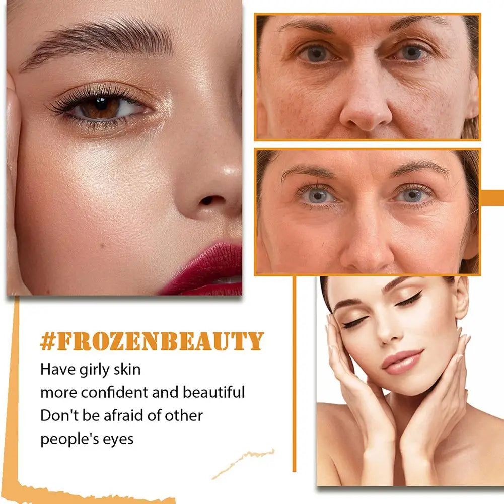 Vitamin C Face Serum Anti Aging And Skin Brightening Serum Dark Spot Remover Vit C Facial Serum With Hyaluronic Acid Skin Care