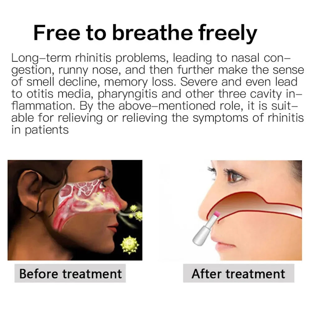BioNase Nasal Rhinitis Sinusitis Cure Therapy Nose Massage Hay Fever Low Frequency Pulse Laser Runny Sneeze Treatment Device
