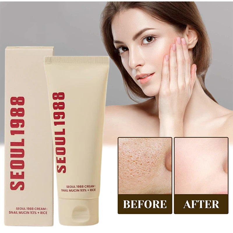Seoul 1988 Snail Mucin Cream 100ml Rice Soothing Moisturizer Skin Antiaging Repair Cream 92% Snail Filtrate Hydrating Face Cream