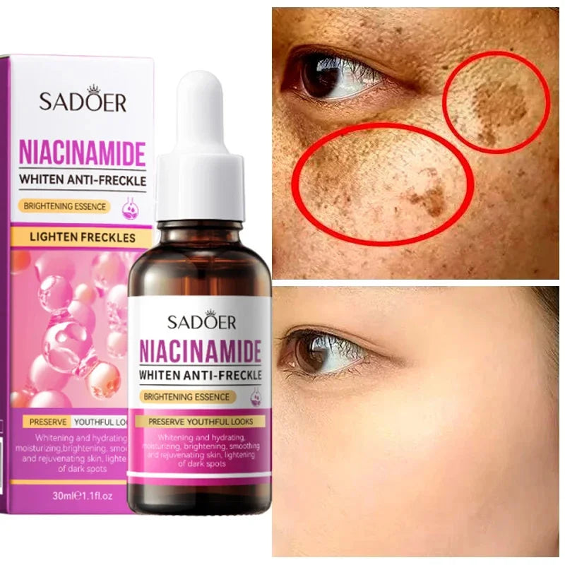 Nicotinamide Salicylic Acid Reduces Stain Facial Essence Whitens Moisturizes Tightens Reduces Melanin Essence Skin Beauty Health