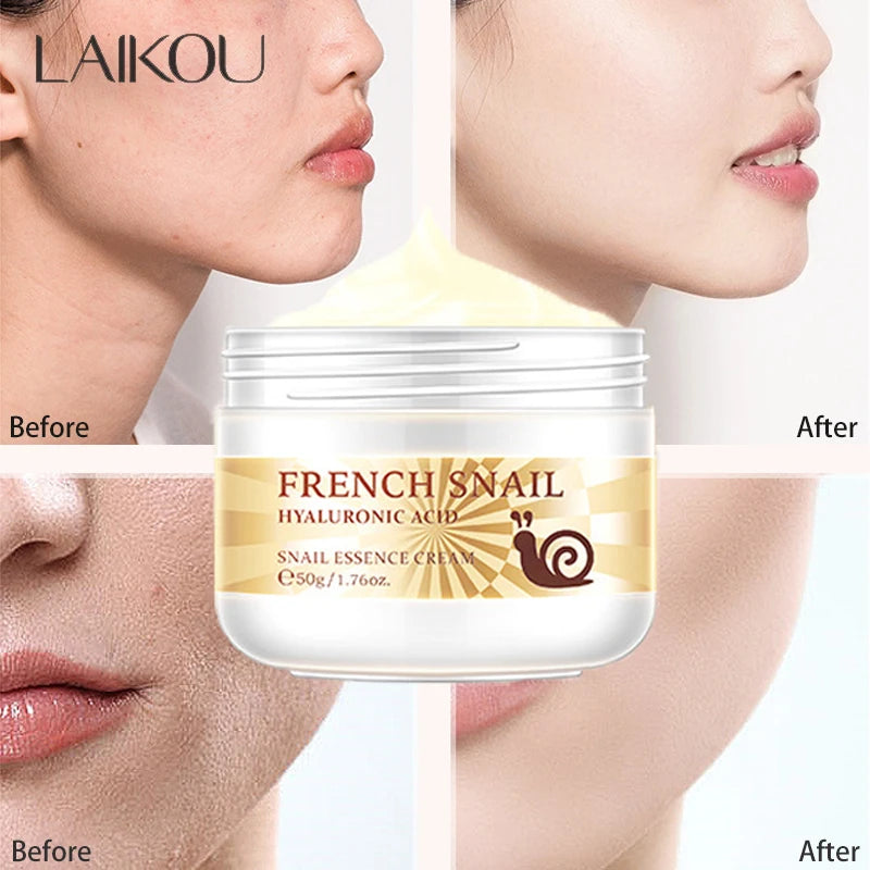 50g Snail Face Cream Improve Dry Rough Skin Smoothing Facial Hyaluronic Acid Moisturizing Nourishing Essences Cream Skin Care