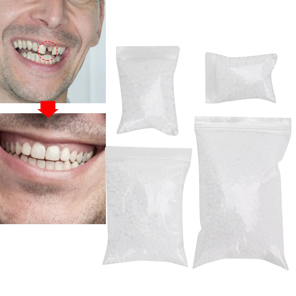 Broken Teeth Repair Temporary Tooth Repair Beads for Missing Broken Teeth Dental Tooth Filling Material