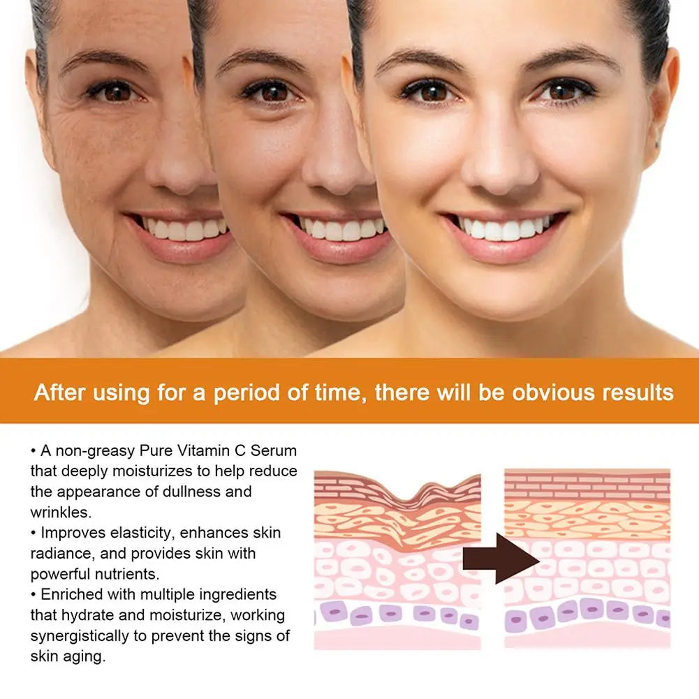 Vitamin C Face Serum Anti Aging And Skin Brightening Serum Dark Spot Remover Vit C Facial Serum With Hyaluronic Acid Skin Care