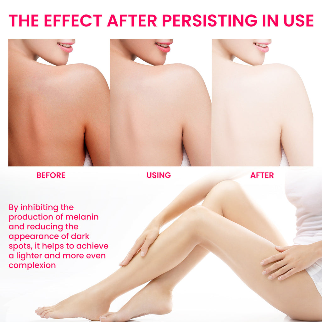 Women's Skin Pigmentation Care